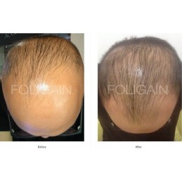 FOLIGAIN Sampon pentru regenerarea parului pentru barbati 2% Trioxidil® (8oz) 236ml Sampon pentru regenerarea parului la barbati