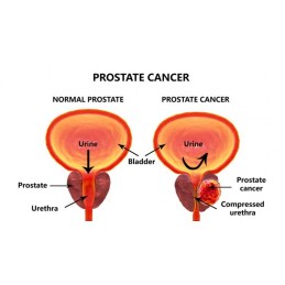 Haya Labs Sanatate Prostata 60 Capsule (pentru prostata) Beneficii Prostate: sustine functia renala, confort urinar, proprietati