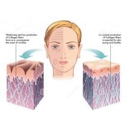 Colagen Hidrolizat, Tip 1 si 3, 120 Capsule, Reduce liniile fine si ridurile, imbunătățește hidratarea si fermitatea pielii Bene